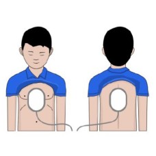 Електроди для дітей AED Amoul